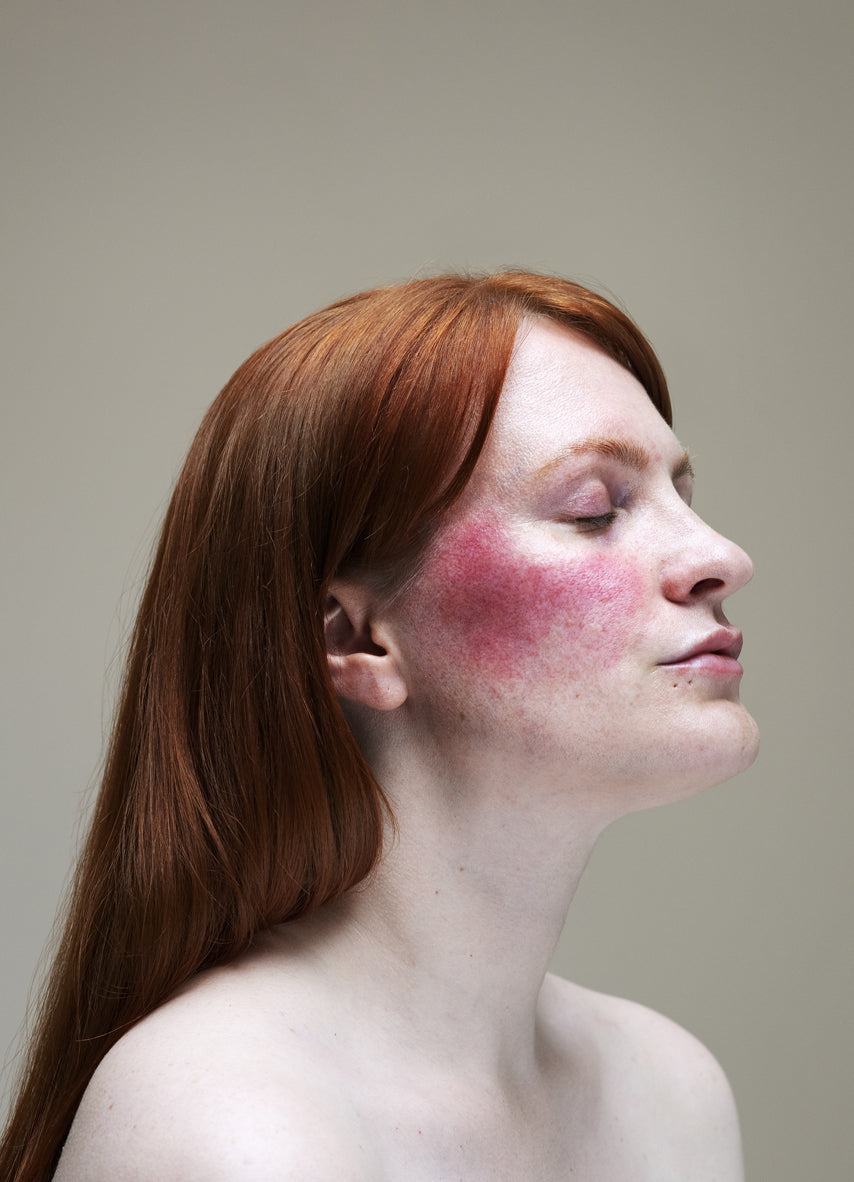 Epidermis: In Conversation with Sophie Harris-Taylor