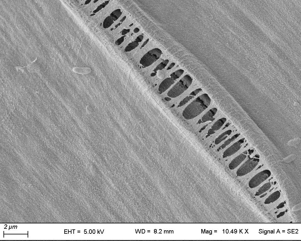 Microscopic image of a textured surface.